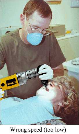 Dentist using right angle power drill